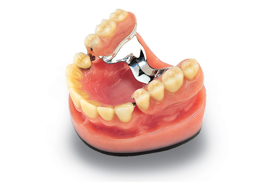 Braces With Dentures Latta SC 29565